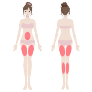 効く部位「お腹＆脚」